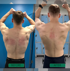 Unisex Anti-Humpback Chest Lift Brace Posture Corrector